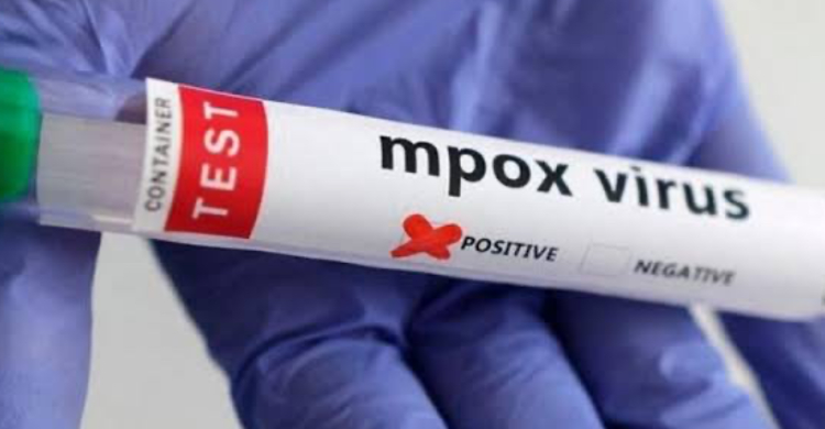 India Konfirmasi Kasus Mpox, Pasien Diisolasi